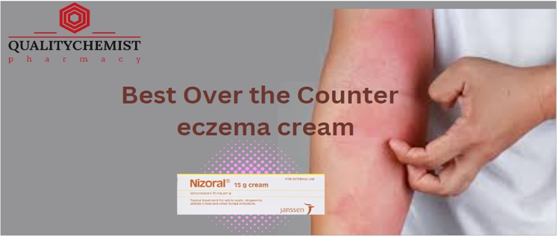 Best over-the-counter eczema cream